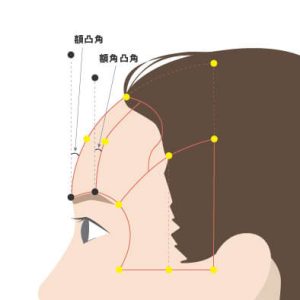 前額美學分析示意圖，額頭凸度特徵解析